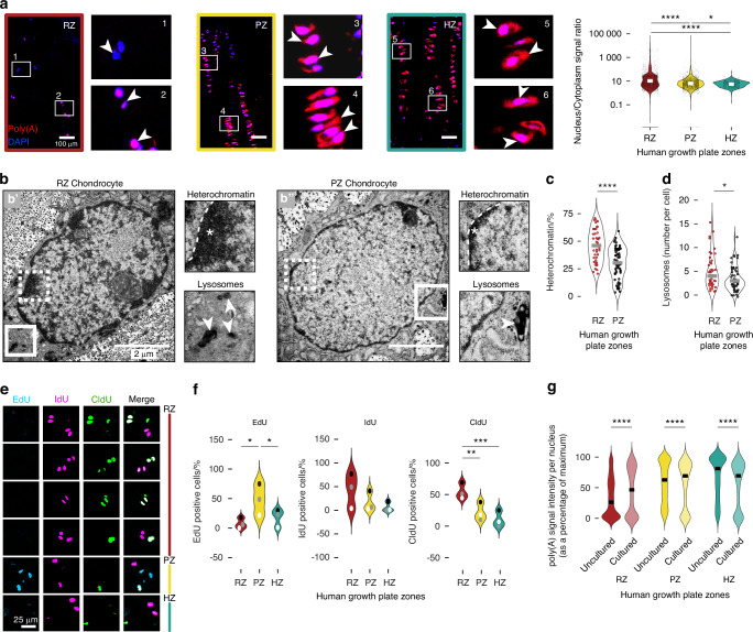 Human growth plate chondrocyte TEM. Resting zone (RZ) and proliferative zone (PZ) chondrocytes showing heterochromatin (asterisks) and lysosomes (arrowheads). Panel b from a study of cellular quiescence in the resting zone.