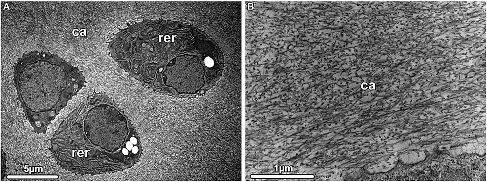 Hyaline cartilage TEM. Chondrocytes arranged in chondrons contain extensive rough endoplasmic reticulum (RER); surrounding matrix shows type II collagen fibrils interspersed with proteoglycans. Six-day-old mouse, demineralized bone.